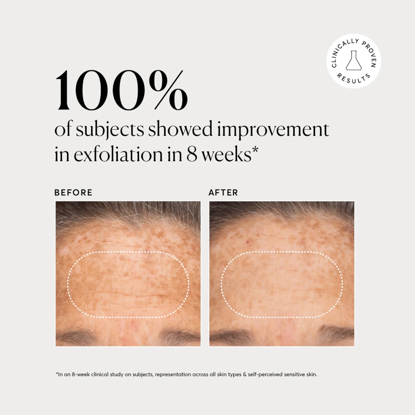 bha-liquid-exfoliant-2-b6 NATR-10027-Alt-Images-BHA-Liquid-Exfoliant-2_-03.webp